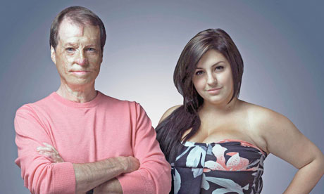  the Channel 4 programme “Beauty and the Beast: Ugly face of prejudice”.